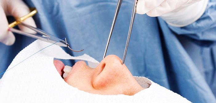 How Does A Person Who Underwent Mouth Or Nose Surgery Perform Ablution?
